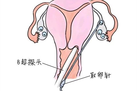 http://wulumuqi.huochezhan.net/post/205.html|乌鲁木齐供卵助孕