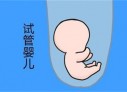 培养乌鲁木齐捐卵宝宝艺术细胞的小技巧